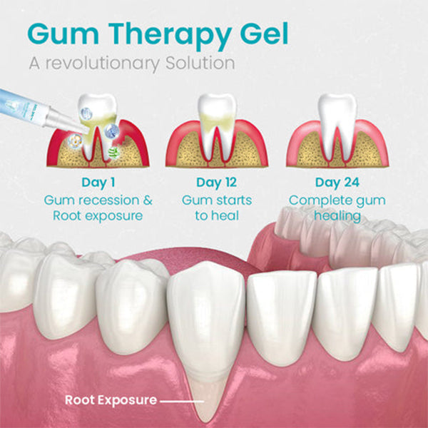 (🎉Last Day Sale-80% Off🔥))NESLEMY™ Gum Shield Therapy Gel