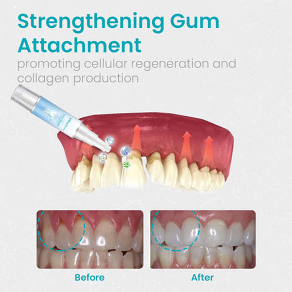 (🎉Last Day Sale-80% Off🔥))NESLEMY™ Gum Shield Therapy Gel