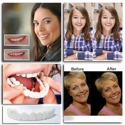 (Limited Time Discount 🔥 Last Day)DIYSTAR™Adjustable Snap-On Dentures⭐