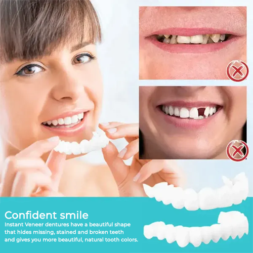 (Limited Time Discount 🔥 Last Day)DIYSTAR™Adjustable Snap-On Dentures⭐