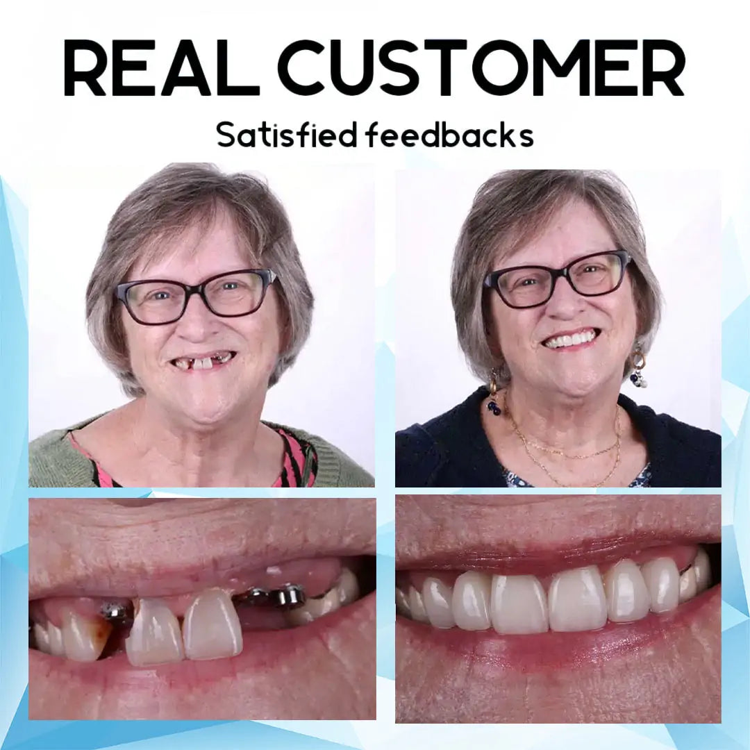 🦷 QIAWI™-Premium Custom Silicone Denture Set 👨⚕️ Dual Certification by the American Dental Association(ADA) & the U.S. Food and Drug Administration(FDA)