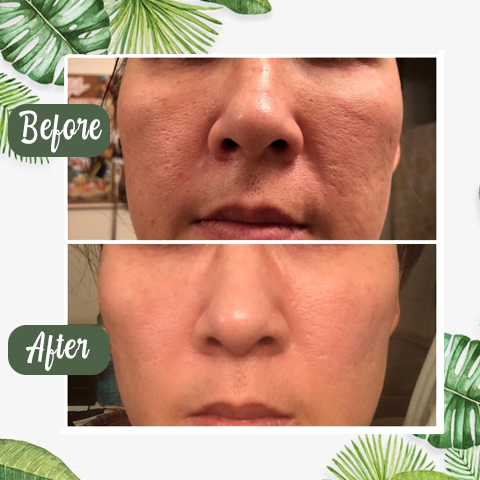 (🔥Hot Sale🔥)Deep Cleanse Green Tea Mask