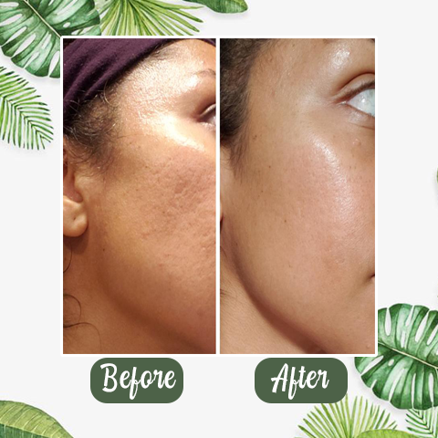 (🔥Hot Sale🔥)Deep Cleanse Green Tea Mask