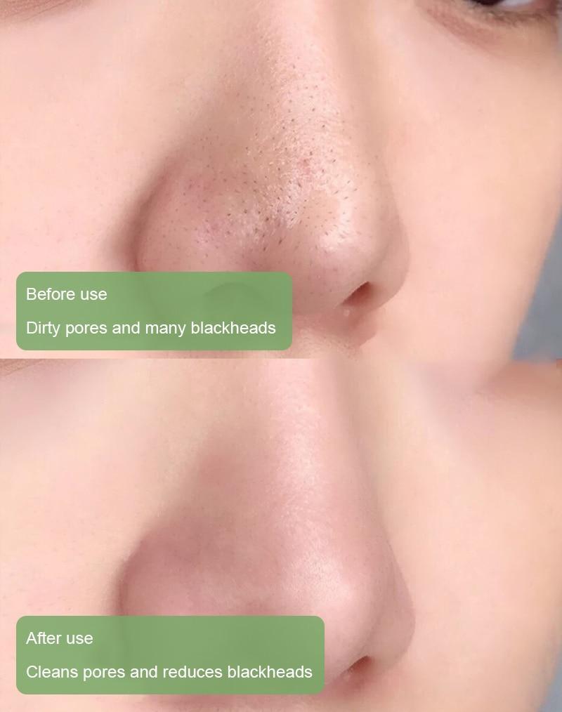 (🔥Hot Sale🔥)Deep Cleanse Green Tea Mask