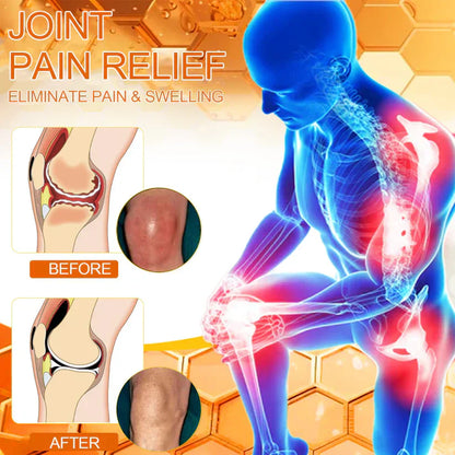🔥Official Store: LOVILDS™ Bee-Poison Pain-Relief Bone Healing Cream👨‍⚕️UK Medicines and Healthcare products Regulatory Agency (MHRA)  Certification(Reducing joint swelling, pain, stiffness, redness, warmth, soreness, and joint fatigue)