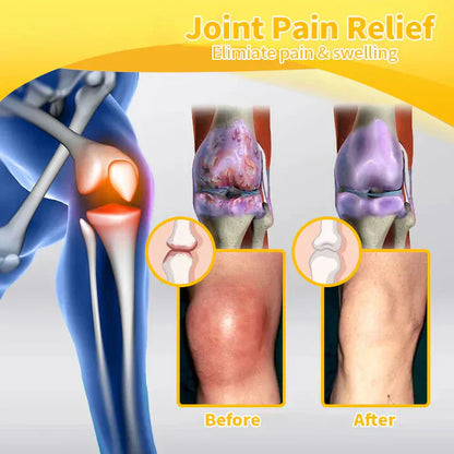 🔥Official Store: LOVILDS™ Bee-Poison Pain-Relief Bone Healing Cream👨‍⚕️UK Medicines and Healthcare products Regulatory Agency (MHRA)  Certification(Reducing joint swelling, pain, stiffness, redness, warmth, soreness, and joint fatigue)