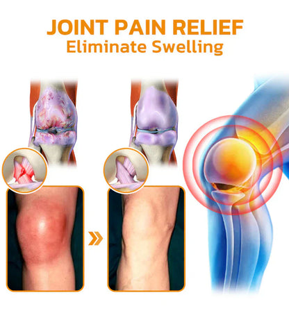 🔥Official Store: LOVILDS™ Bee-Poison Pain-Relief Bone Healing Cream👨‍⚕️UK Medicines and Healthcare products Regulatory Agency (MHRA)  Certification(Reducing joint swelling, pain, stiffness, redness, warmth, soreness, and joint fatigue)