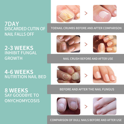 LOVILDS™ Nail Care Pen