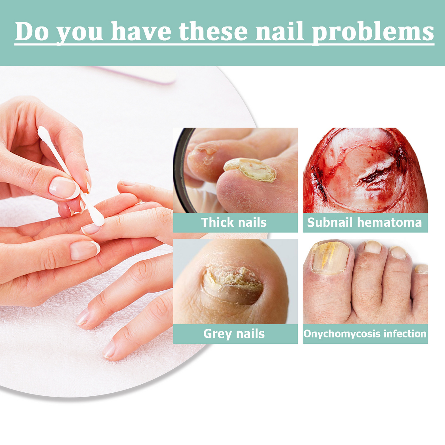 LOVILDS™ Nail Care Pen