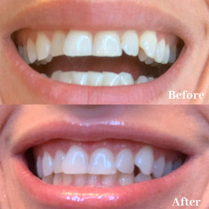 Newyuo™ Triple Whitening Toothpaste, Brightening & Stain Removal & Freshening Breath