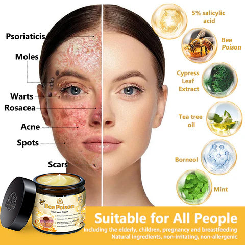 LOVILDS™ Bee Poison Skin Treatment Cream (AAD Recommended)🍓🍓
