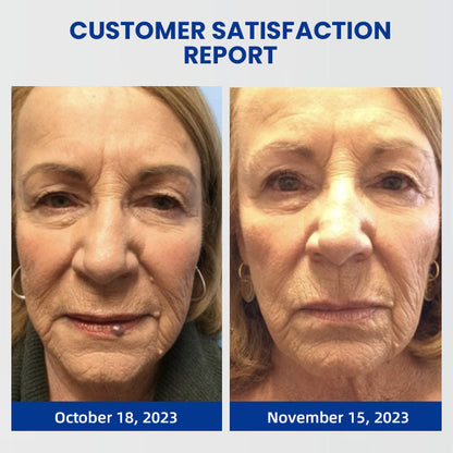 (🔥Last Day Sale-80% Off🔥)Lovilds™ Instant Blemish Removal Cream