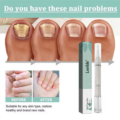 LOVILDS™ Nail Care Pen