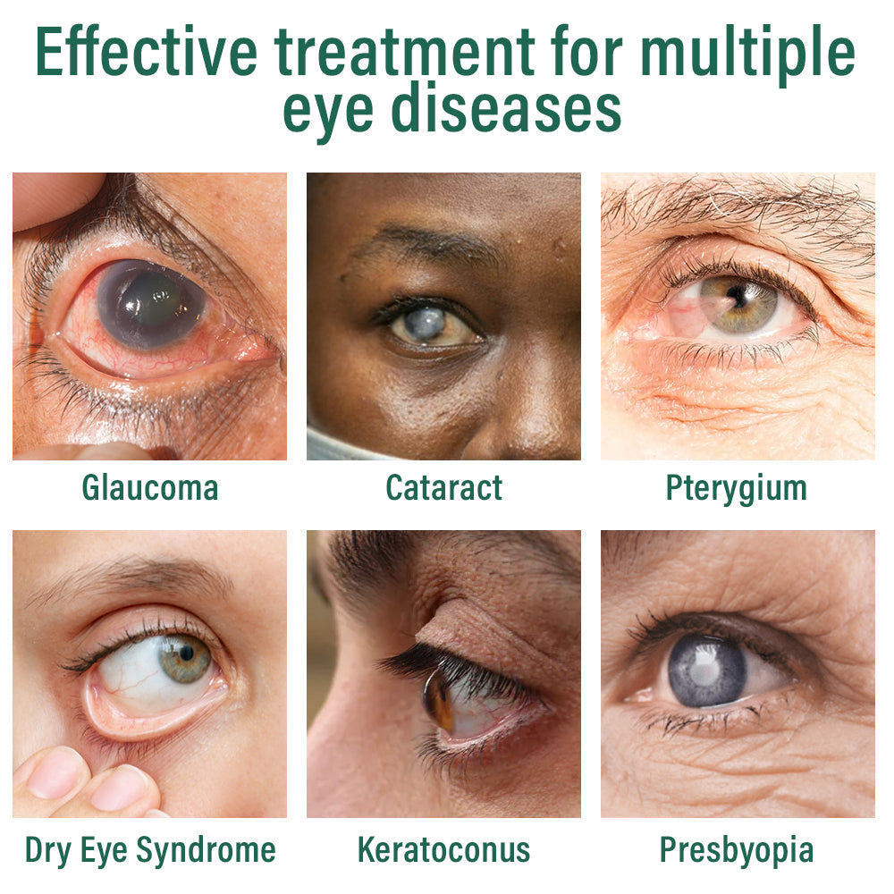 👩‍⚕️LOVILDS™ Nano Eye Drops Serum ✅FDA Approved(Suitable for presbyopia, dry eye syndrome, glaucoma, and cataracts) 👀