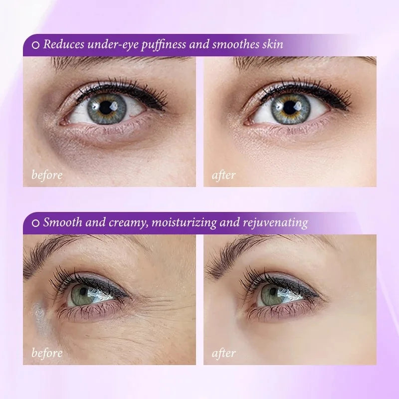 LOVILDS Skin Renewing Eye Cream For Wrinkles | Paraben Free & Opthalmologist Tested
