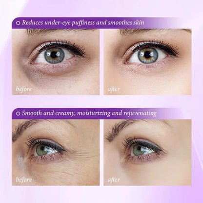 LOVILDS Skin Renewing Eye Cream For Wrinkles | Paraben Free & Opthalmologist Tested