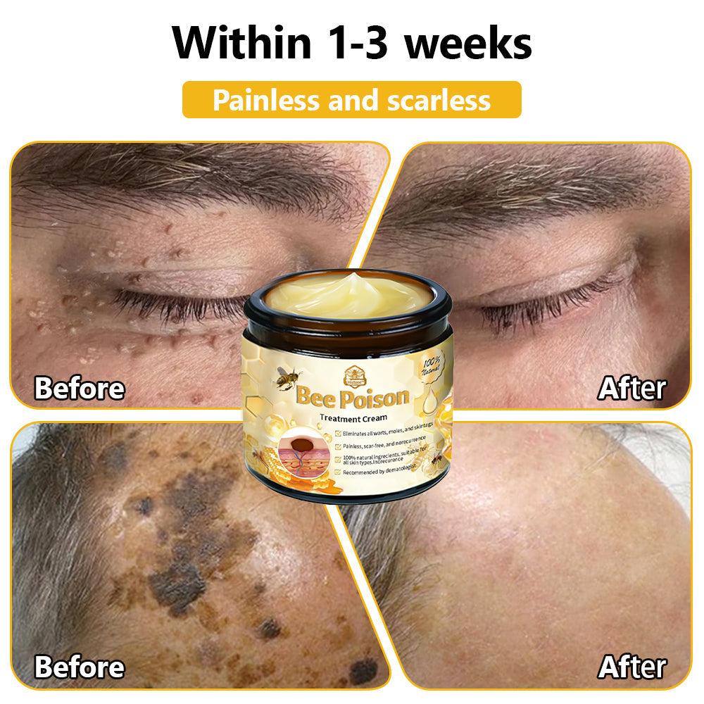 LOVILDS™ Bee Poison Skin Treatment Cream (AAD Recommended)🍓🍓