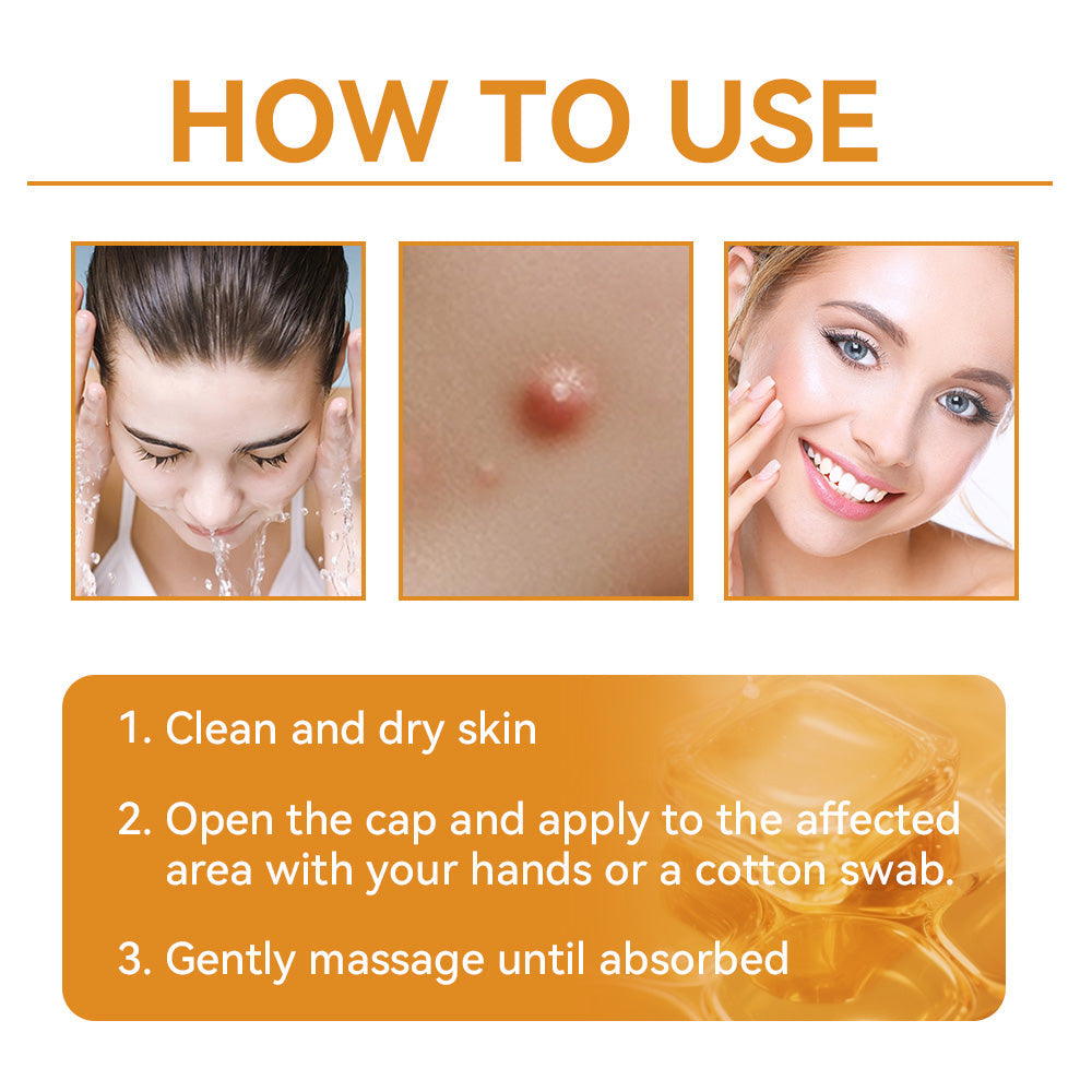 LOVILDS™ Bee Poison Skin Treatment Cream (AAD Recommended)🍓🍓