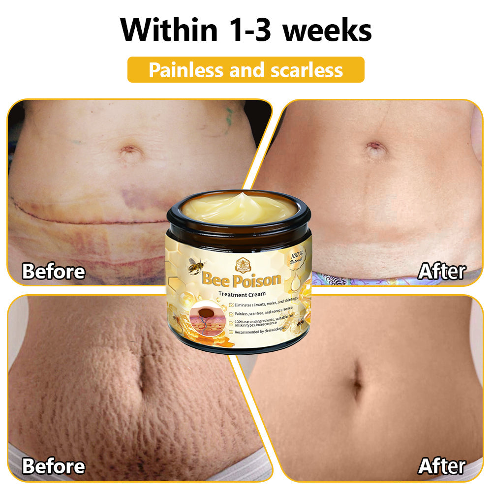 LOVILDS™ Bee Poison Skin Treatment Cream (AAD Recommended)🍓🍓