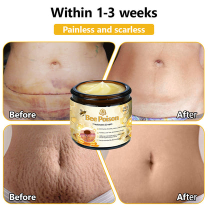 LOVILDS™ Bee Poison Skin Treatment Cream (AAD Recommended)🍓🍓