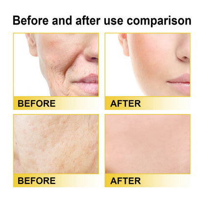 BBOJI™ Serum Vitamin C Facial Serum Lightens Fine Lines Firms and Smoothes Moisturizes Skin Anti-Aging Essence