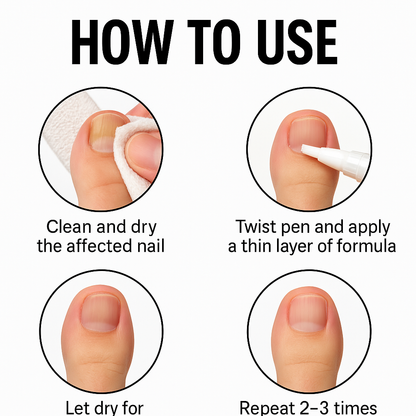 NEWYUO™ Anti-Fungal Pen – Gets Rid Of Even the Most Stubborn Nail Fungus