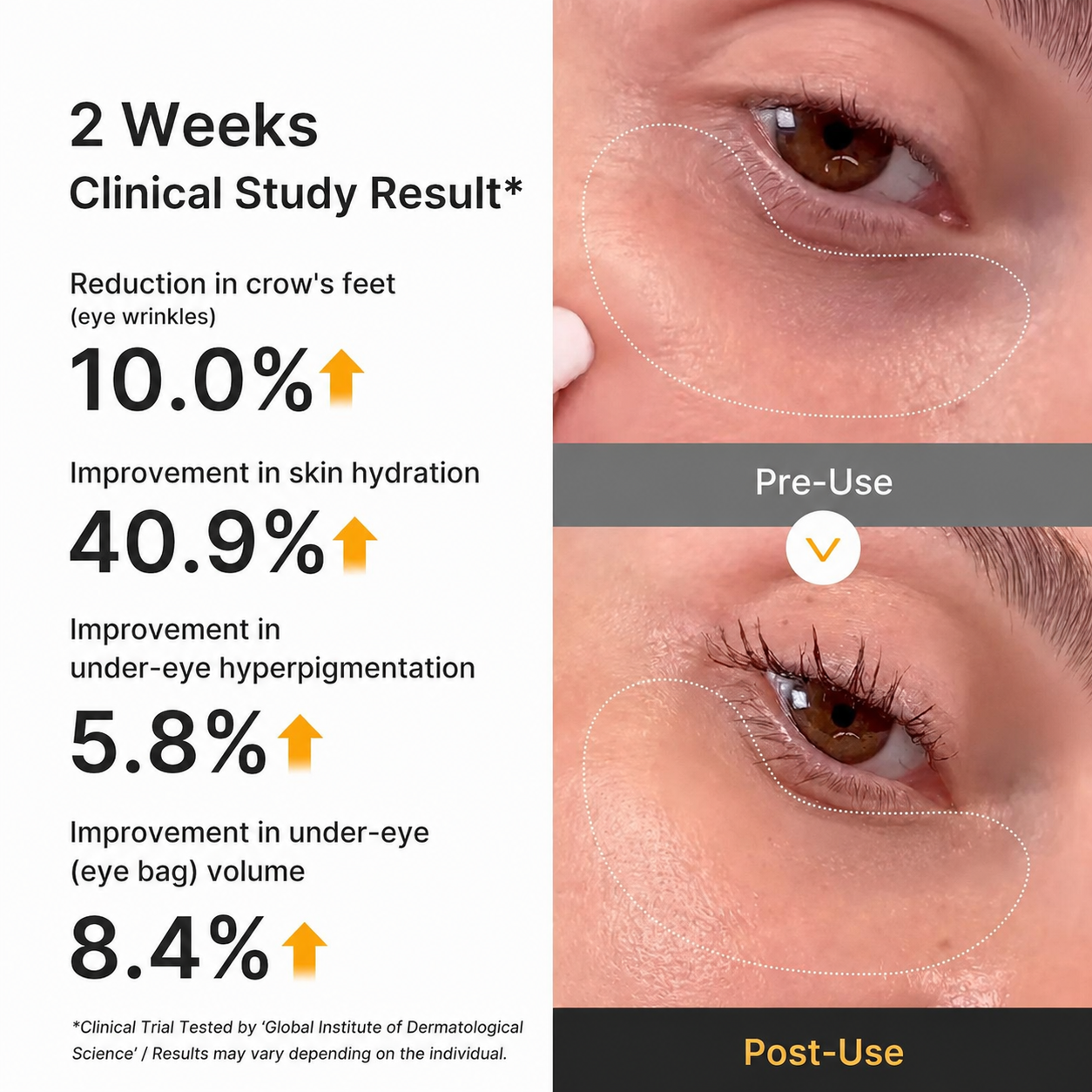 [Cheeringsoul]Kojic Acid Turmeric Vita Jelly Eye Mask