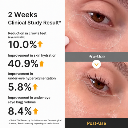 [Cheeringsoul]Kojic Acid Turmeric Vita Jelly Eye Mask