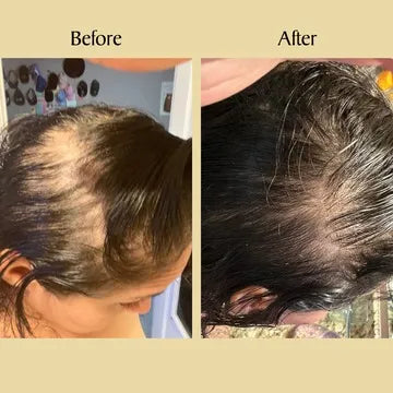 Newyuo™ Natural Hair Growth Oil