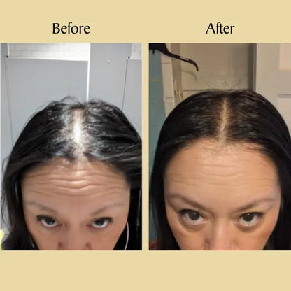 Newyuo™ Natural Hair Growth Oil