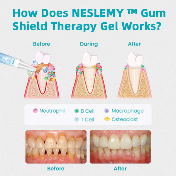 (🔥Last Day Sale-80% Off🔥)NESLEMY™ Gum Shield Therapy Gel