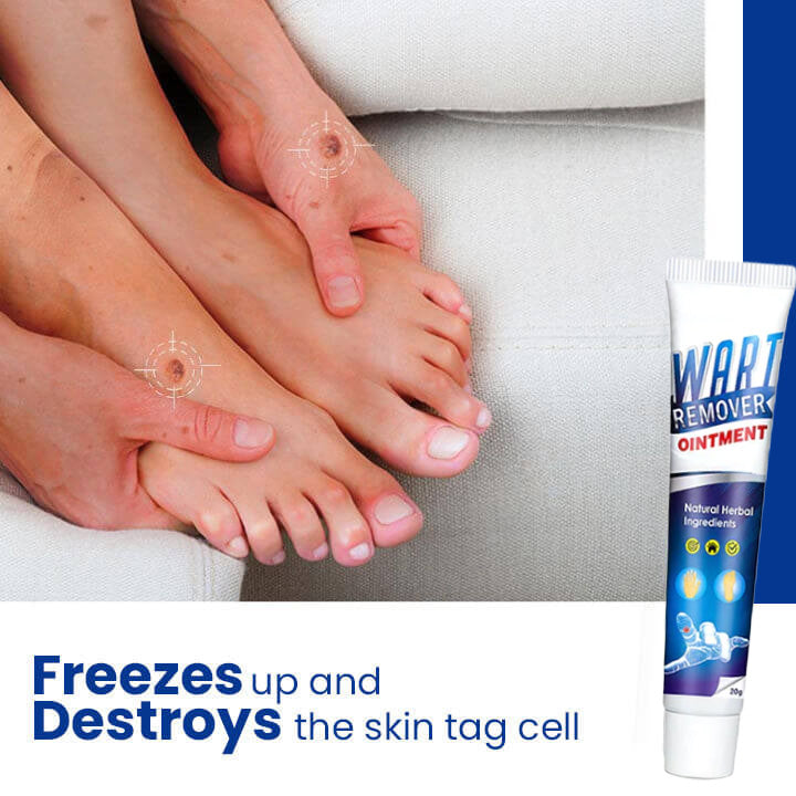 (🔥Last Day Sale-80% Off🔥)Lovilds™ Instant Blemish Removal Cream