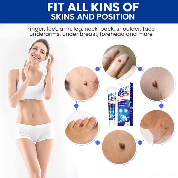 (🔥Last Day Sale-80% Off🔥)Lovilds™ Instant Blemish Removal Cream
